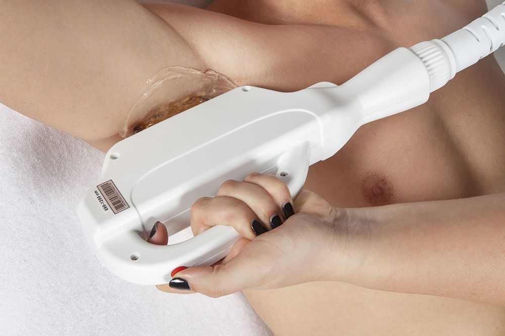 Épilation lumière pulsée aisselles homme