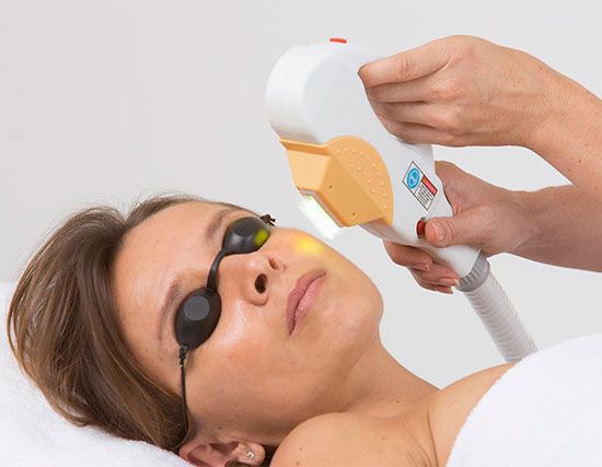 séance photo-rejuvenation par lumière pulsée