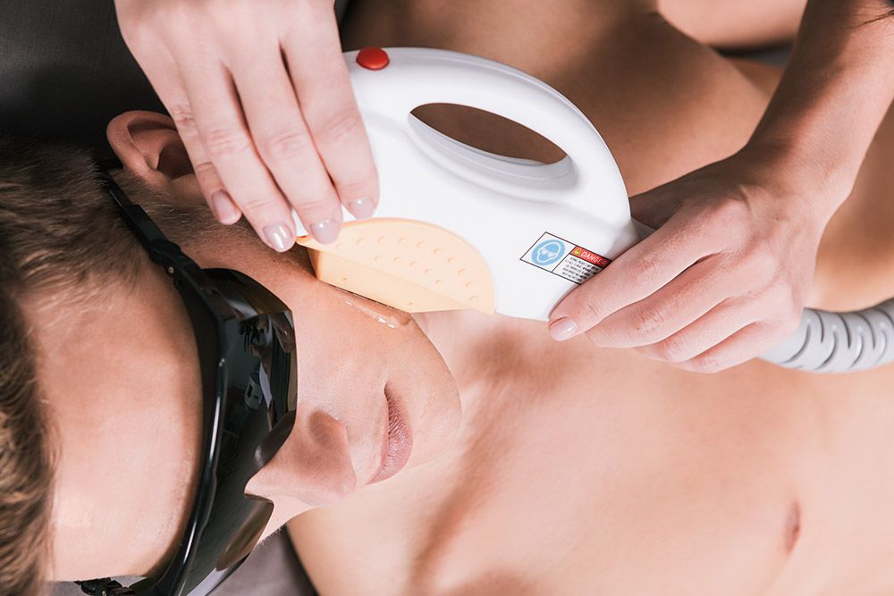 Épilation du visage par lumière pulsée